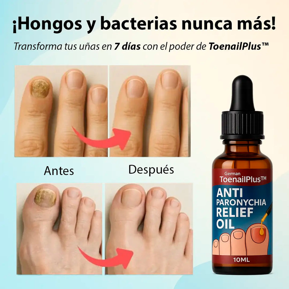 Anti Hongo ToenailPlus: Elimina Hongos de Uñas de Manera Eficaz y Rápida