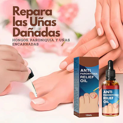 Anti Hongo ToenailPlus: Elimina Hongos de Uñas de Manera Eficaz y Rápida